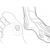 Simone_Militz_Podologia_Sao_Paulo_Unhas_encravadas_Frieiras_Tratamento_para _Calos